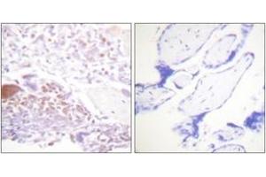 Immunohistochemistry (IHC) image for anti-Cyclin-Dependent Kinase Inhibitor 1C (p57, Kip2) (CDKN1C) (AA 267-316), (pThr310) antibody (ABIN1531619)