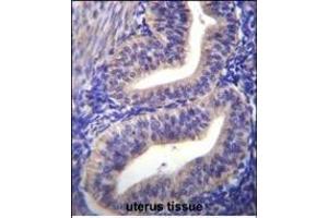 TBPL2 Antibody (N-term) (ABIN656105 and ABIN2845447) immunohistochemistry analysis in formalin fixed and paraffin embedded human uterus tissue followed by peroxidase conjugation of the secondary antibody and DAB staining. (Tbpl2 Antikörper  (N-Term))