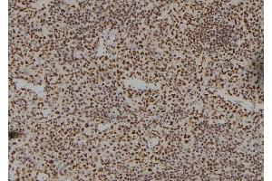 ABIN6262339 and ABIN6279487 at 1/100 staining Mouse spleen tissue by IHC-P. (Homeobox A11 Antikörper)