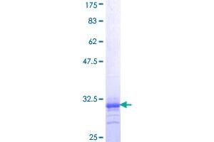 alpha 1 Adrenergic Receptor Protein (AA 1-27) (GST tag)