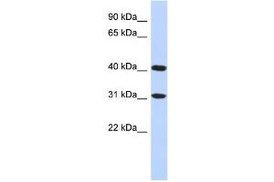 WB Suggested Anti-FAM46D Antibody Titration: 0. (FAM46D Antikörper  (Middle Region))