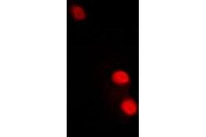 Immunofluorescent analysis of TFIIF RAP 30 staining in A549 cells. (GTF2F2 Antikörper)