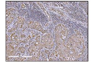 IHC analysis of FABP-1/GOT2 using anti-FABP-1/GOT2 antibody (ABIN7601426). (GOT2 Antikörper  (AA 35-430))
