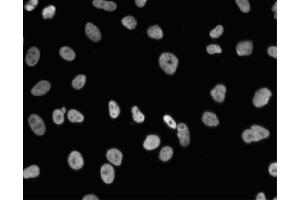 Immunofluorescent staining of A549 (ATCC CCL-185) cells. (NONO Antikörper  (AA 368-471))