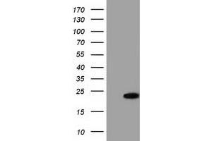 Western Blotting (WB) image for anti-Acireductone Dioxygenase 1 (ADI1) antibody (ABIN1496484)