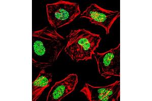 Fluorescent confocal image of Hela cell stained with HAND2 Antibody (Center) (ABIN1538642 and ABIN2848660). (HAND2 Antikörper  (AA 81-110))