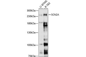 Western blot analysis of extracts of various cell lines, using SCN2A antibody (ABIN6130717, ABIN6147435, ABIN6147436 and ABIN6214873) at 1:1000 dilution. (SCN2A Antikörper  (AA 275-401))