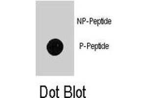 Dot blot analysis of MAP1LC3B (phospho T12) polyclonal antibody  on nitrocellulose membrane. (LC3B Antikörper  (pThr12))