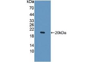 Western blot analysis of recombinant Human IL10Rb. (IL10RB Antikörper  (AA 87-243))