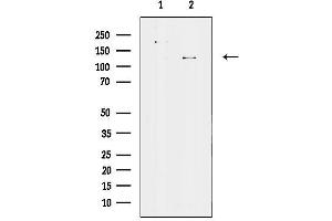 Western blot analysis of lysates from mouse brain tissue, using ATP8 Antibody.