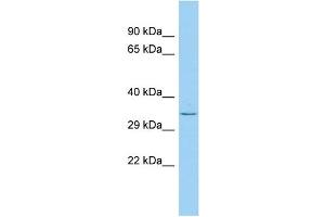 Host: Rabbit Target Name: PLD5 Sample Type: Fetal Lung lysates Antibody Dilution: 1. (PLD5 Antikörper  (C-Term))