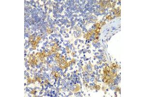 Immunohistochemistry of paraffin-embedded rat spleen using NOTCH1 antibody. (Notch1 Antikörper)