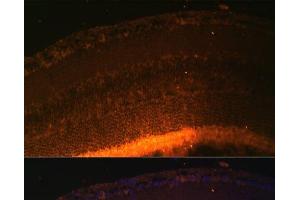 Immunofluorescence analysis of Mouse retina using GRK1 Polyclonal Antibody at dilution of 1:100 (40x lens). (GRK1 Antikörper)
