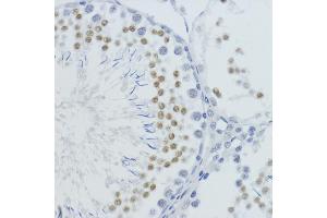 Immunohistochemistry (IHC) image for anti-Histone H4 (meLys20) antibody (ABIN3016045)