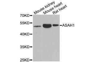 Western blot analysis of extracts of various cell lines, using ASAH1 antibody. (ASAH1 Antikörper  (AA 140-389))