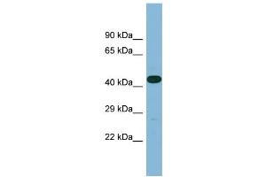 Western Blotting (WB) image for anti-Leucine Rich Repeat Containing 49 (LRRC49) (C-Term) antibody (ABIN2787019) (LRRC49 Antikörper  (C-Term))