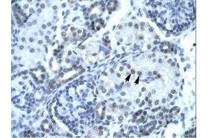 Image no. 1 for anti-Paired Box Gene 2a (PAX2A) (AA 174-223) antibody (ABIN202997) (PAX2A Antikörper  (AA 174-223))