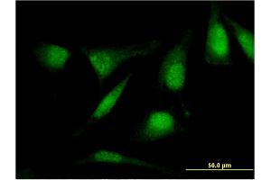 Immunofluorescence of monoclonal antibody to RASSF4 on HeLa cell. (RASSF4 Antikörper  (AA 1-321))