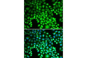 Immunofluorescence analysis of U2OS cells using PSMA4 antibody (ABIN6291447). (PSMA4 Antikörper)