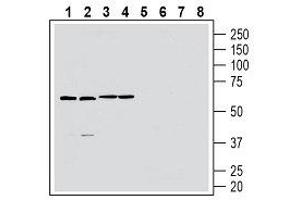 Western blot analysis of rat brain membranes (lanes 1 and 5), mouse brain lysate (lanes 2 and 6), rat spleen lysate (lanes 3 and 7) and mouse spleen membranes (lanes 4 and 8): - 1-4. (GPR174 Antikörper  (2nd Extracellular Loop))