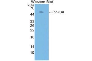 Western blot analysis of the recombinant protein. (MAPK7 Antikörper  (AA 560-793))