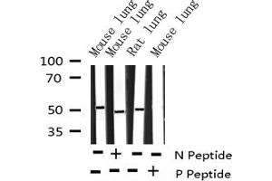Western blot analysis of Phospho-AML1 (Ser276) expression in various lysates