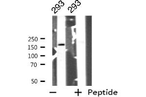 Western blot analysis of GRF-1 expression in 293 whole cell lysates,The lane on the left is treated with the antigen-specific peptide. (GRLF1 Antikörper  (Internal Region))
