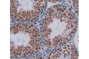 Used in DAB staining on fromalin fixed paraffin- embedded testis tissue (HMG20B Antikörper  (AA 1-213))