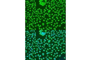 Immunofluorescence analysis of U2OS cells using POU5F1 antibody. (OCT4 Antikörper)