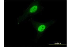 Immunofluorescence of monoclonal antibody to CAPN3 on HeLa cell. (Calpain 3 Antikörper  (AA 210-309))