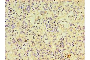 Immunohistochemistry (IHC) image for anti-Protein tyrosine Phosphatase, Non-Receptor Type 5 (Striatum-Enriched) (PTPN5) (AA 300-555) antibody (ABIN7174112)