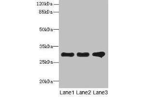 Western blot All lanes: RMDN1 antibody at 0. (FAM82B Antikörper  (AA 13-314))