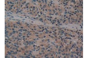 Immunohistochemistry (IHC) image for anti-Fucosidase, alpha-L- 1, Tissue (FUCA1) (AA 53-289) antibody (ABIN7432667)