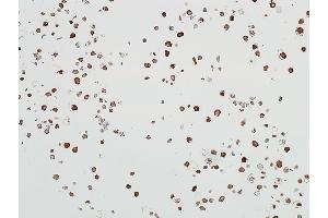 Immunocytochemistry (ICC) image for anti-Aldehyde Dehydrogenase 1 Family, Member A1 (ALDH1A1) (AA 300-350) antibody (ABIN7453956)