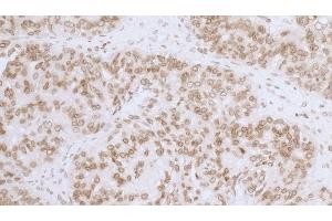 anti-LAP2 beta gamma/tmpo (AA 404-454) antibody