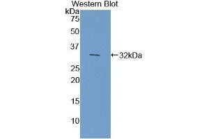 Detection of Recombinant CYP7A1, Mouse using Polyclonal Antibody to Cytochrome P450 7A1 (CYP7A1) (CYP7A1 Antikörper  (AA 227-467))