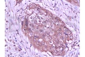 Immunohistochemistry (IHC) image for anti-Signal Transducer and Activator of Transcription 3 (Acute-Phase Response Factor) (STAT3) (AA 233-330) antibody (ABIN738261)