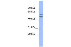 WB Suggested Anti-DKC1 Antibody Titration:  0. (DKC1 Antikörper  (N-Term))