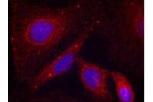 Immunofluorescence staining of methanol-fixed Hela cells using PAK1(Phospho-Thr212) Antibody. (PAK1 Antikörper  (pThr212))
