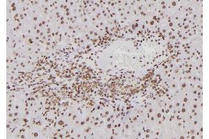 ABIN6276797 at 1/100 staining Mouse liver tissue by IHC-P. (BTRC Antikörper  (N-Term))