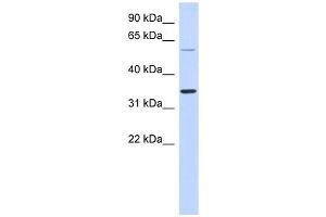 SASP antibody used at 1 ug/ml to detect target protein. (ASPRV1 Antikörper  (Middle Region))