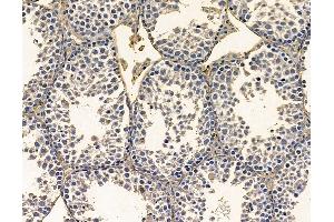 anti-Protein Prenyltransferase alpha Subunit Repeat Containing 1 (PTAR1) antibody