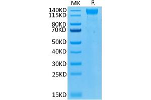 Biotinylated Human VEGF R2 on Tris-Bis PAGE under reduced condition. (VEGFR2/CD309 Protein (AA 20-764) (His-Avi Tag,Biotin))