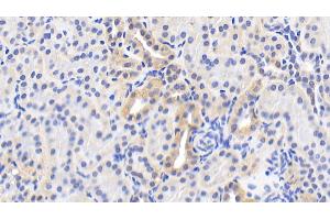 Immunohistochemistry (IHC) image for anti-Heat Shock 60kDa Protein 1 (Chaperonin) (HSPD1) (AA 1-573) antibody (ABIN7432685)