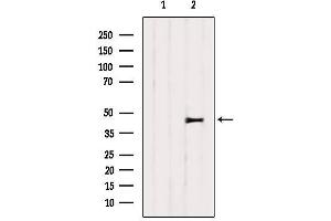 Western blot analysis of extracts from 3T3, using SERPINH1 Antibody. (SERPINH1 Antikörper  (Internal Region))