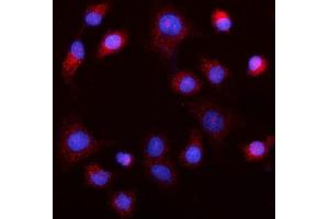 IF analysis of MEK5/MAP2K5 using anti-MEK5/MAP2K5 antibody (ABIN7601657). (MAP2K5 Antikörper  (AA 401-445))