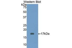 Western Blotting (WB) image for anti-CD3d Molecule, delta (CD3-TCR Complex) (CD3D) (AA 18-113) antibody (ABIN1175133)