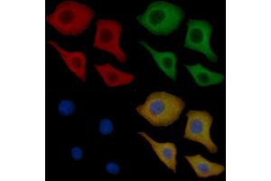 GABBR2 Mouse Monoclonal Antibody staining Hela cells by IF/ICC.