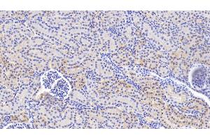 Detection of VCL in Human Kidney Tissue using Anti-Vinculin (VCL) Polyclonal Antibody (Vinculin Antikörper  (AA 1020-1134))