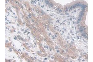 IHC-P analysis of Mouse Uterus Tissue, with DAB staining. (FAM3B Antikörper  (AA 30-235))